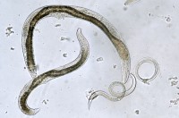 Nematelmintos Filo Nematoda Biologia Infoescola